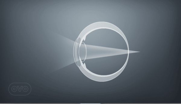 LASIK Eye Surgery | OVO LASIK + LENS, Minneapolis