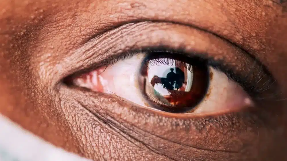 Cataract Surgery Recovery Tips | OVO LASIK + LENS Minnesota